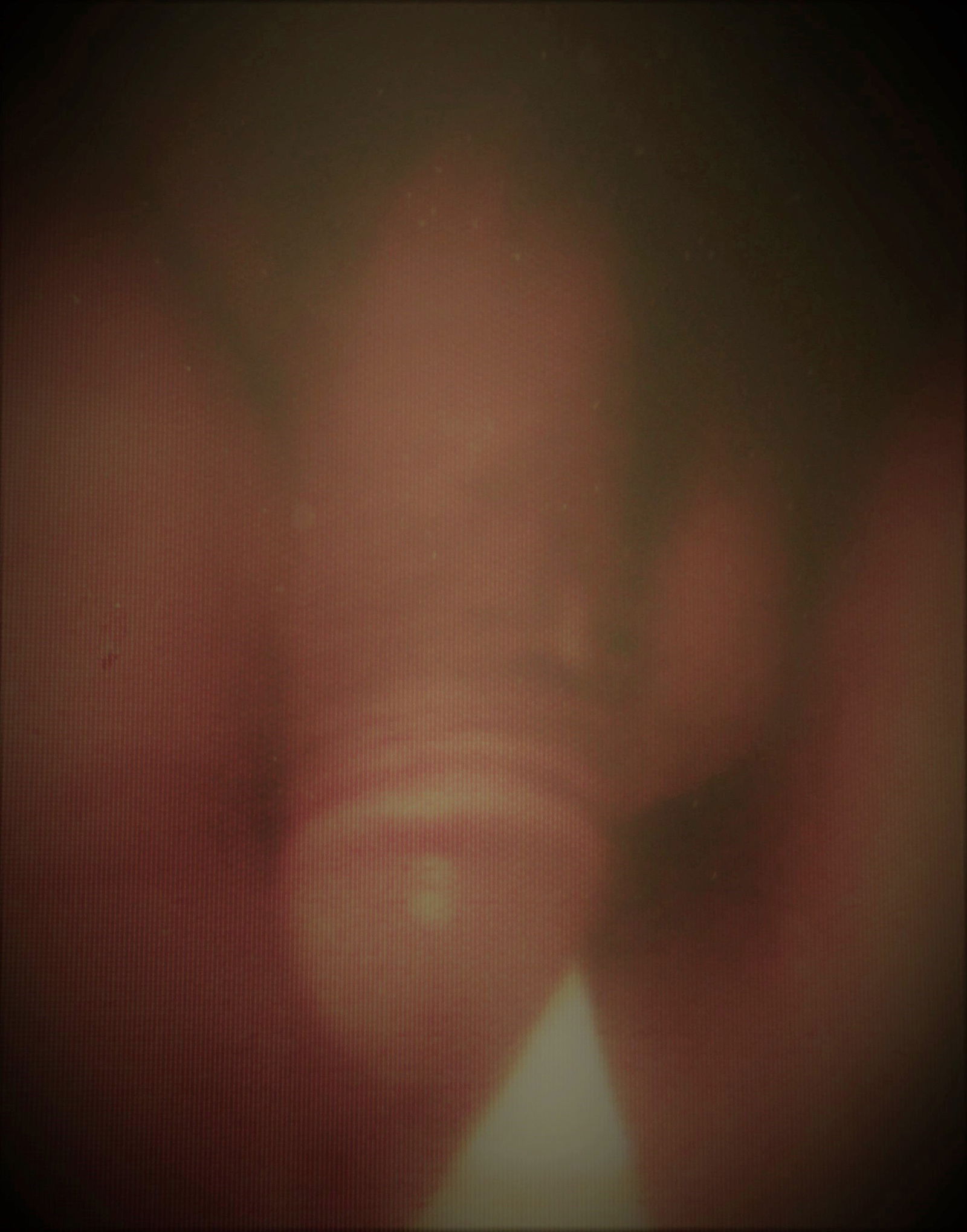 v01.JPG