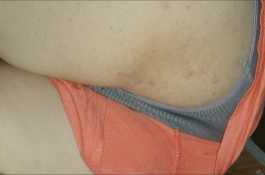 熟睡的嬸嬸（58y）